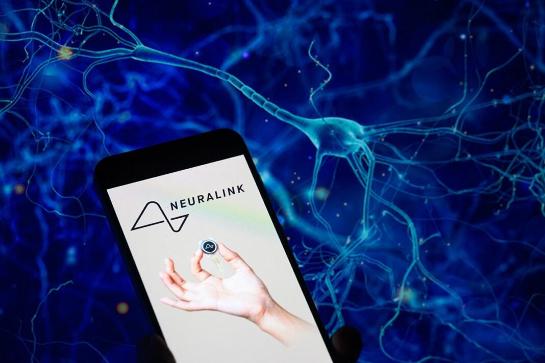 neuralink:-Εμφύτευμα-«μεταφράζει»-σκέψεις-σε-κείμενο-για-ασθενείς-χωρίς-φωνή