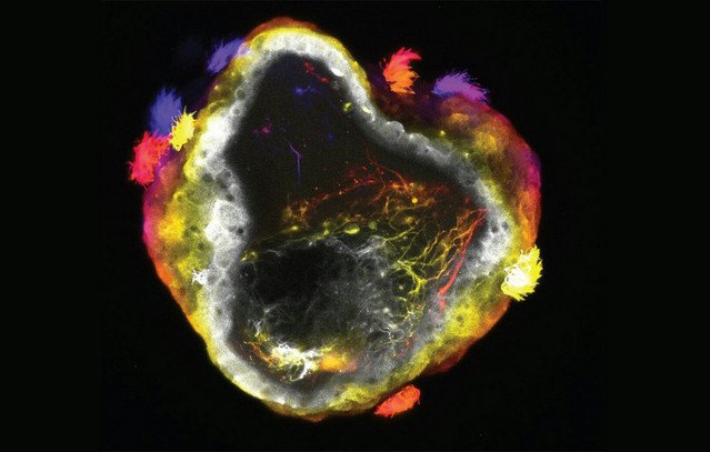 Νευρορομπότ:-Η-νέα-γενιά-«ζωντανών»-μηχανών-με-εγκέφαλο-αλλάζει-τα-δεδομένα-στην-επιστήμη